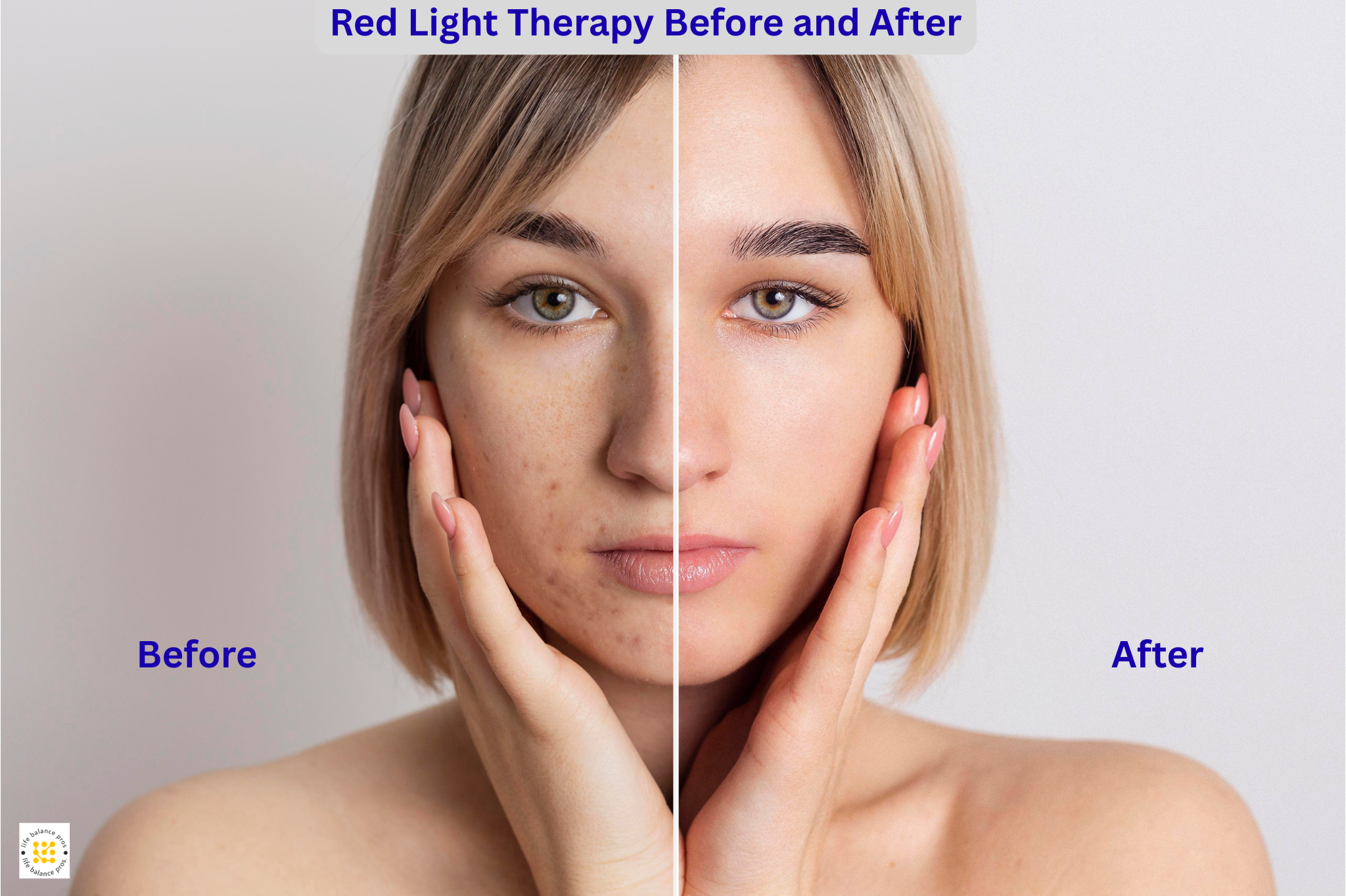 Red Light Therapy Before and After: Not the Results You’re Expecting